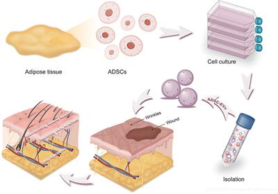 The Therapeutic Role of ADSC-EVs in Skin Regeneration